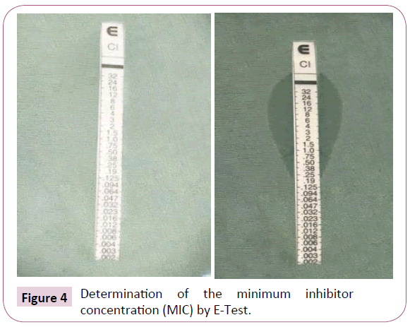 Archives-Clinical-Microbiology-minimum-inhibitor