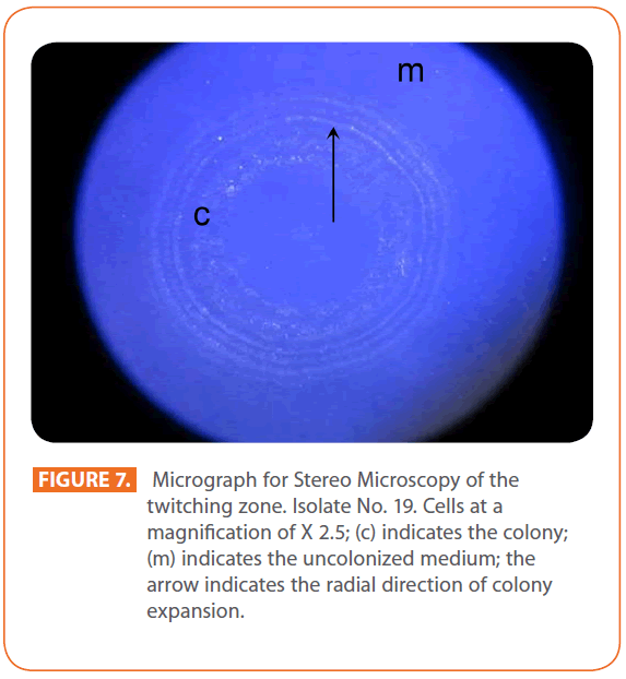 Archives-Clinical-Microbiology-twitching-zone-Isolate