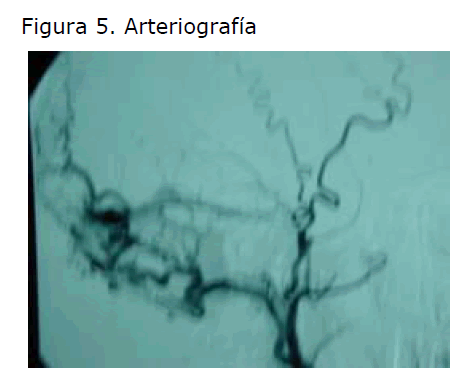 Archivos-de-Medicina-Arteriografia