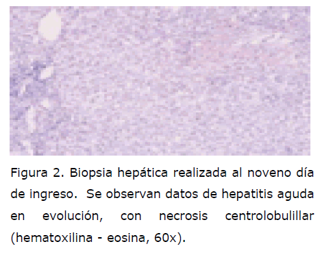 Archivos-de-Medicina-Biopsia-hepatica