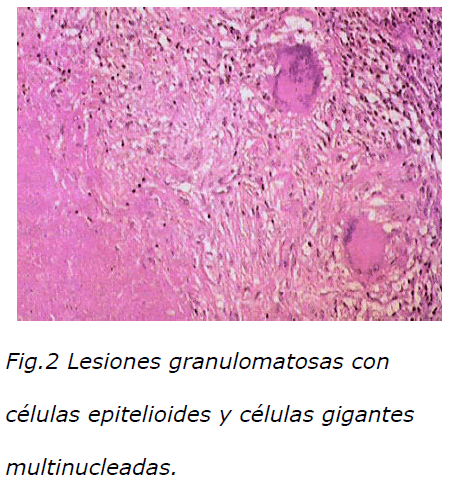 Archivos-de-Medicina-Lesiones-granulomatosas