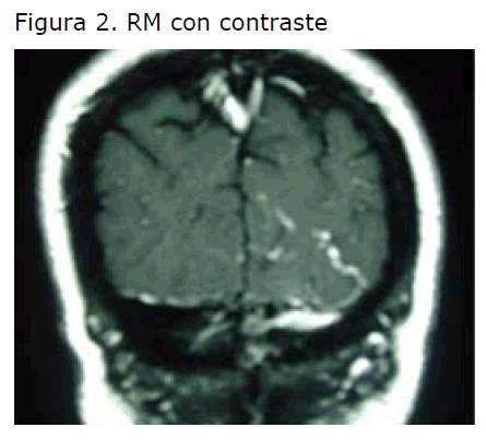 Archivos-de-Medicina-RM-con-contraste