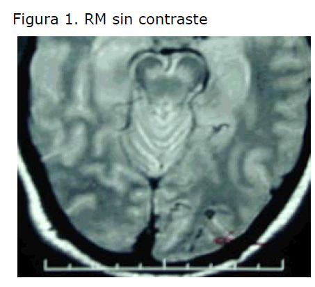 Archivos-de-Medicina-RM-sin-contraste