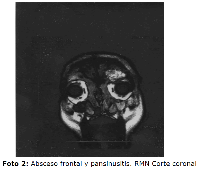 Archivos-de-Medicina-RMN-Corte-coronal