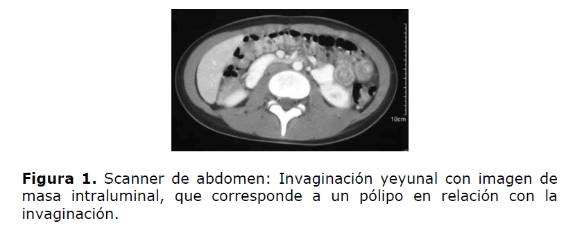 Archivos-de-Medicina-Scanner-de-abdomen