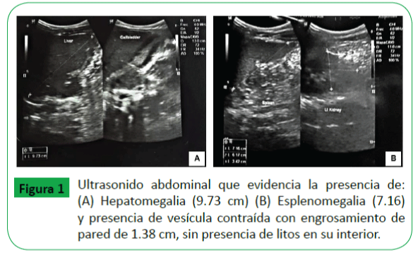 Archivos-de-Medicina-Ultrasonido-abdominal-que