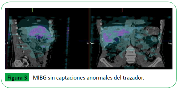 Archivos-de-Medicina-anormales-del-trazador