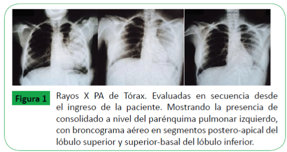 Archivos-de-Medicina-diaria-Rayos-X-PA-de