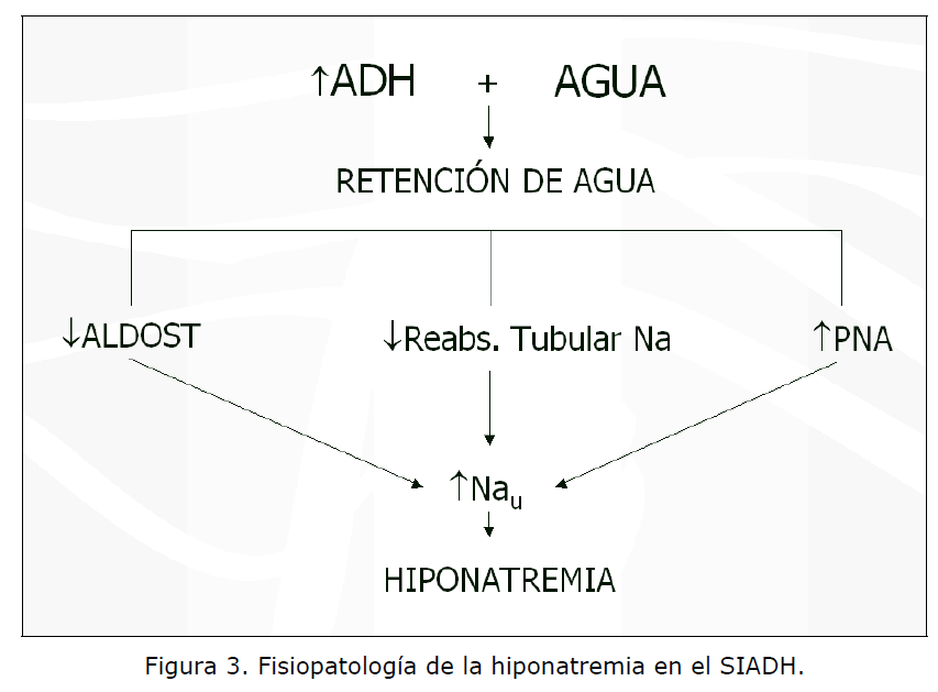 Archivos-de-Medicina-hiponatremia-SIADH