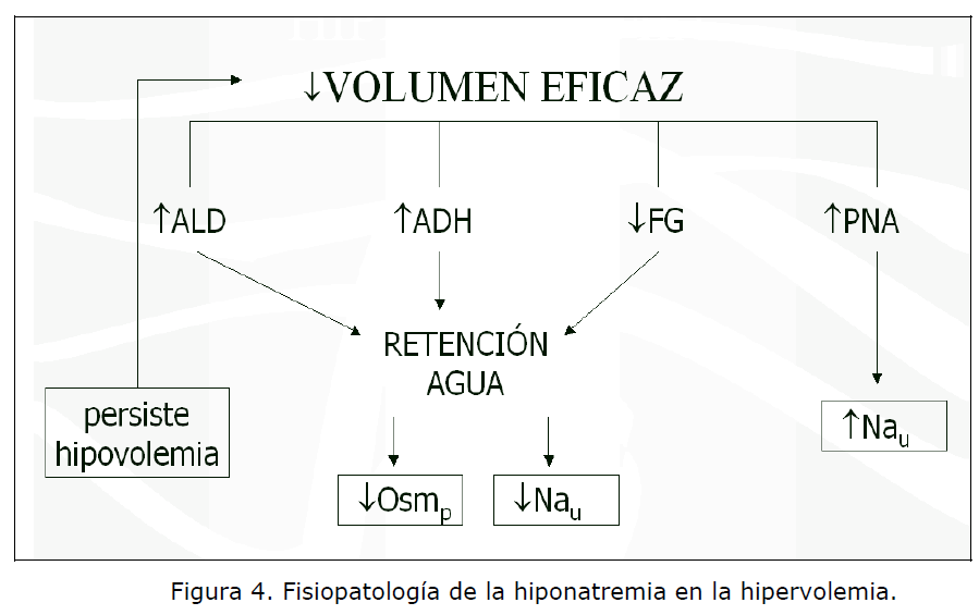 Archivos-de-Medicina-hiponatremia-hipervolemia