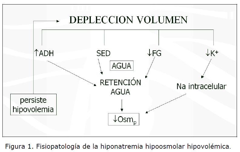 Archivos-de-Medicina-hiponatremia-hipoosmolar