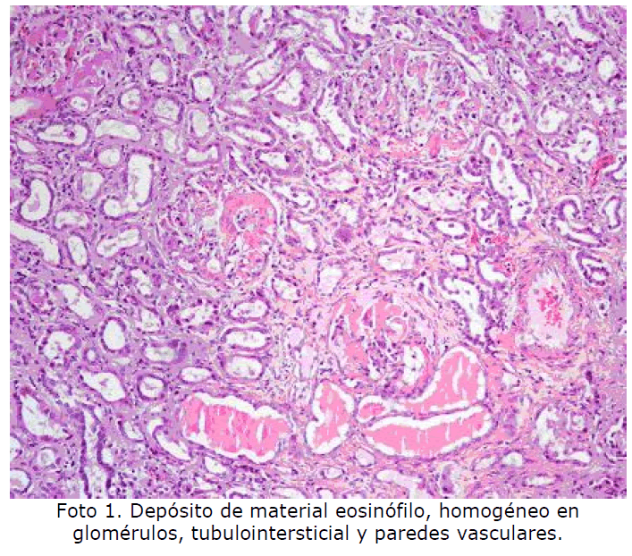 Archivos-de-Medicina-material-eosinofilo