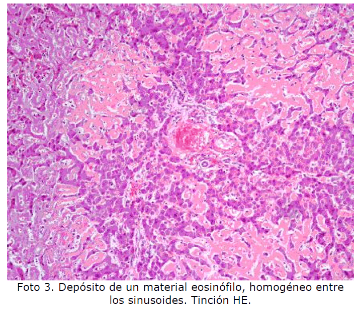 Archivos-de-Medicina-material-eosinofilo