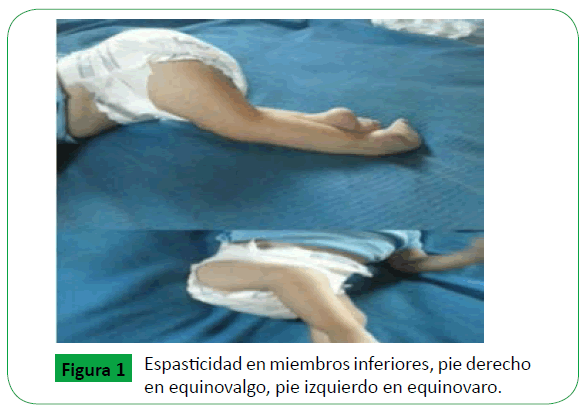 Archivos-de-Medicina-miembros-inferiores