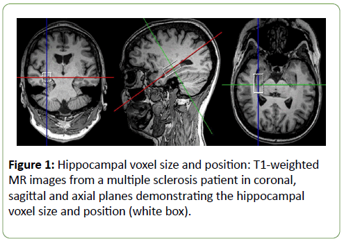 Biomedical-Sciences-Hippocampal-voxel