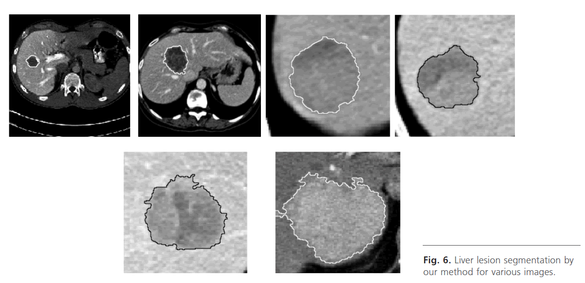 Biomedical-Sciences-Liver-lesion