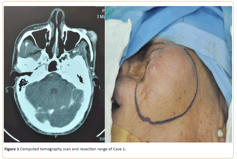 Cancer-Research-Computed-tomography-scan