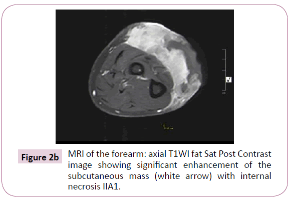 Cancer-Research-Post-Contrast