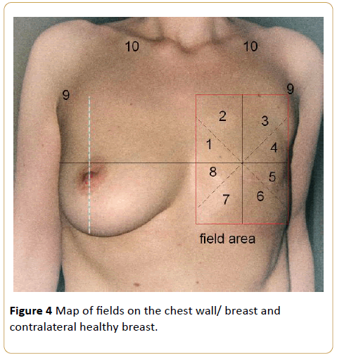 Cancer-Research-contralateral-healthy-breast