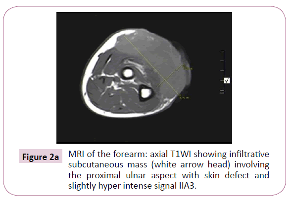 Cancer-Research-white-arrow