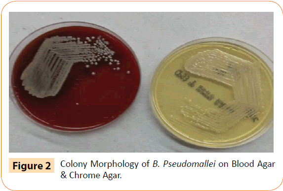Clinical-Microbiology-Chrome-Agar