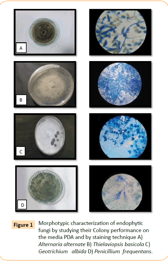 Clinical-Microbiology-Penicillium-frequentans