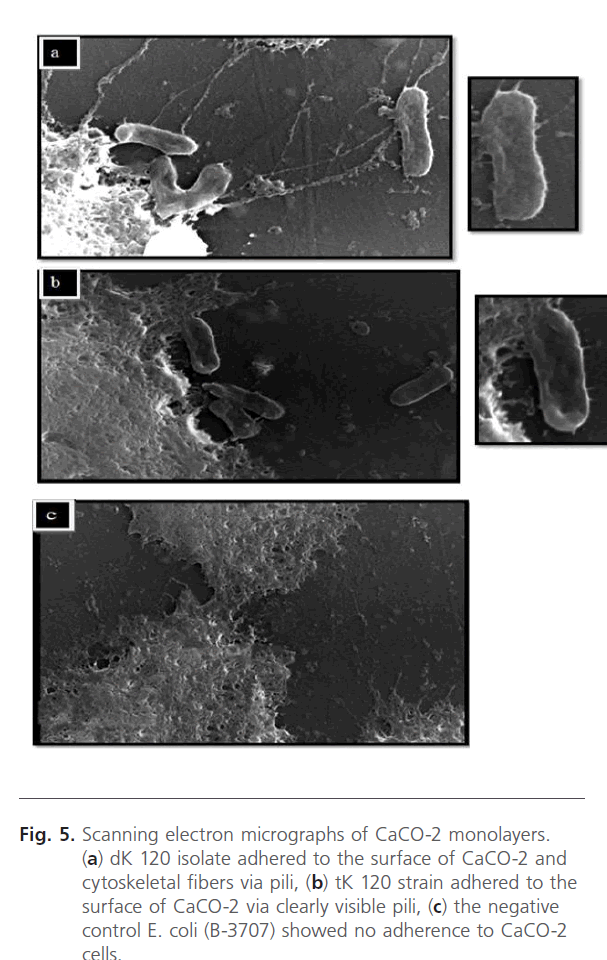 Clinical-Microbiology-electron-micrographs