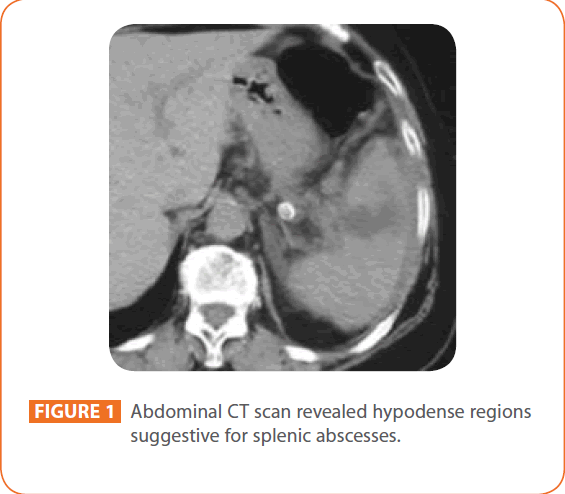 Clinical-Microbiology-splenic-abscesses