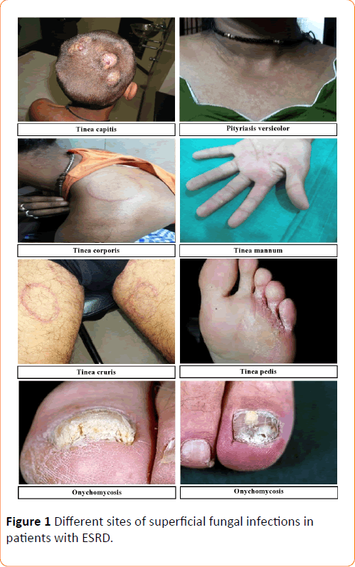 Clinical-Microbiology-superficial-fungal