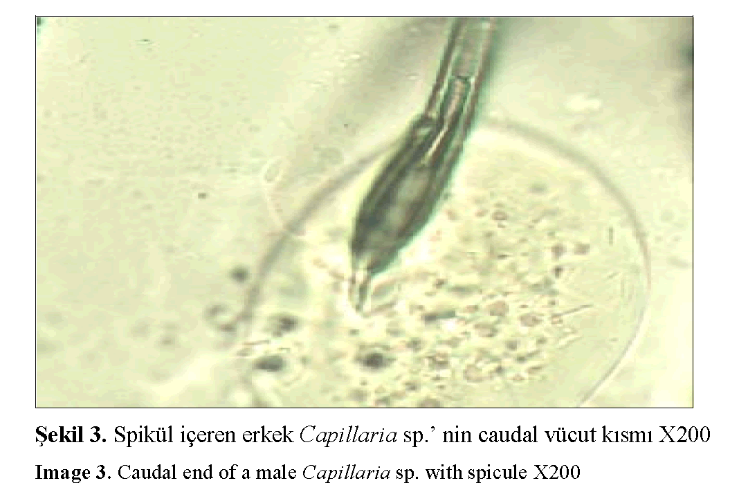 Fisheries-Sciences-Caudal-end-male-Capillaria-sp-with-spicule-X200