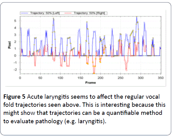 HSJ-Acute-laryngitis-regular-vocal