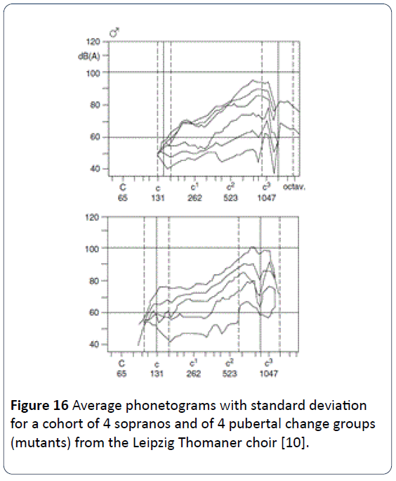 HSJ-Average-phonetograms-standard-cohort