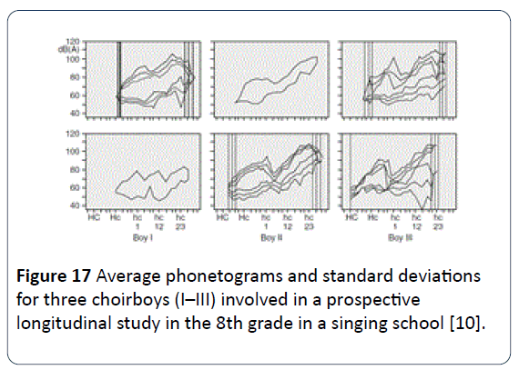 HSJ-Average-phonetograms-three-choirboys