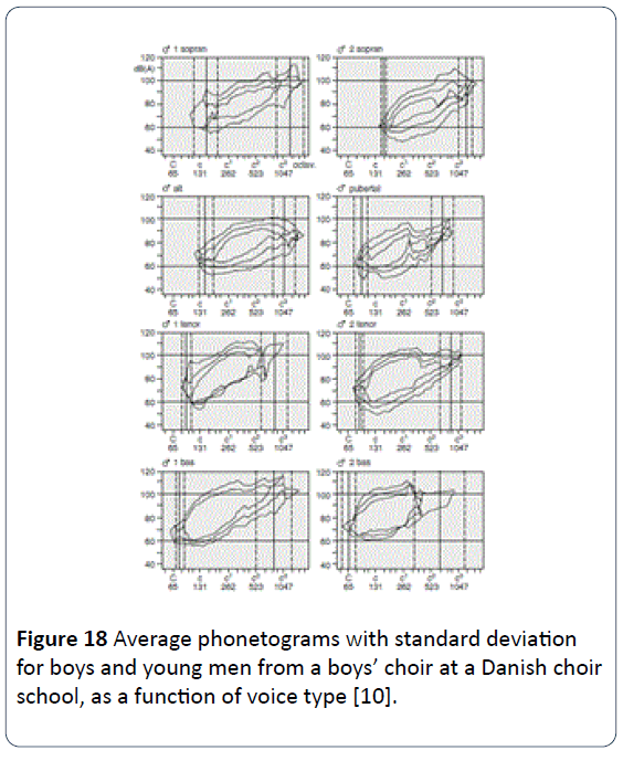 HSJ-Average-phonetograms-young-men