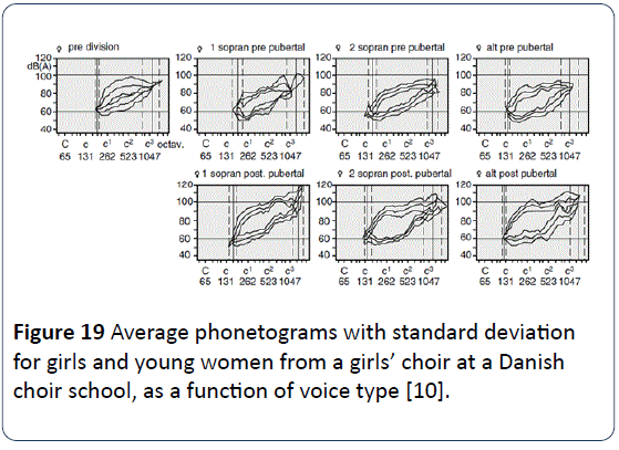 HSJ-Average-phonetograms-young-women