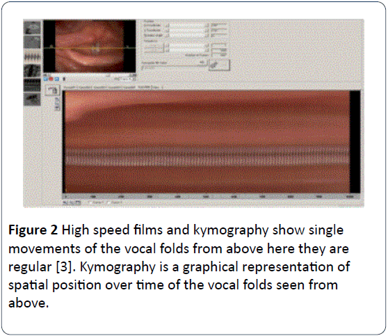 HSJ-High-speed-films-kymography