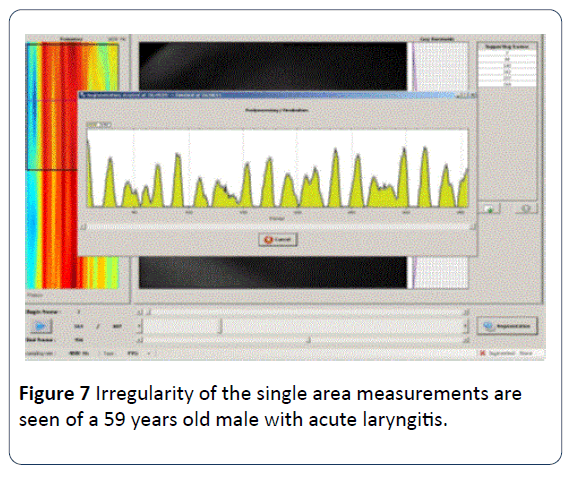 HSJ-Irregularity-single-area-measurements