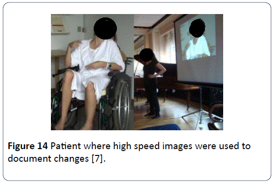HSJ-Patient-high-speed-images