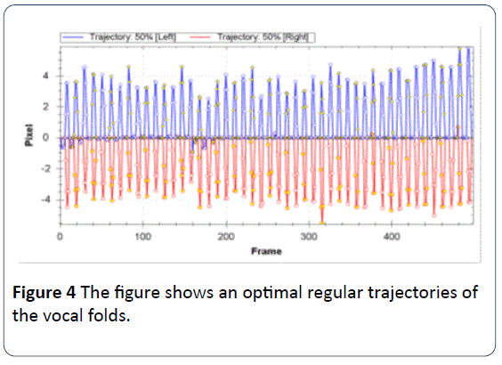 HSJ-optimal-regular-trajectories