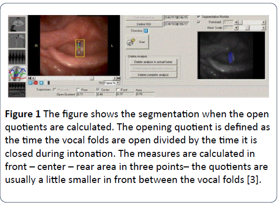 HSJ-segmentation-quotients-calculated