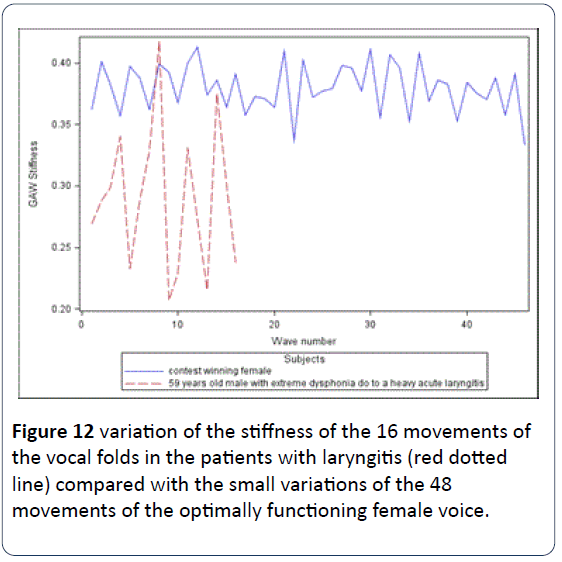 HSJ-variation-stiffness-patients-laryngitis