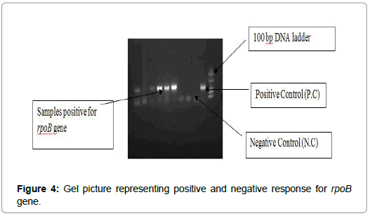 International-Journal-Gel-picture