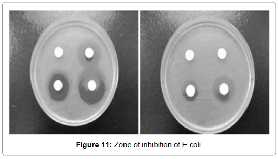 International-Journal-zone-inhibition