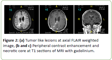 Neurology-Neuroscien-enhancement
