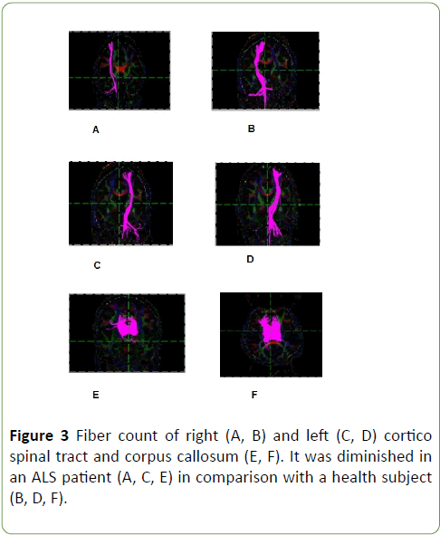 Neurology-Neuroscien-fiber-count