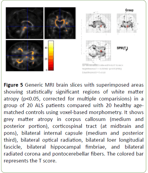 Neurology-Neuroscien-significant