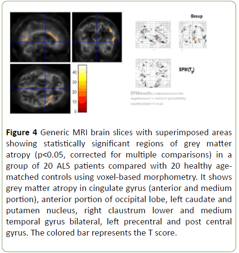 Neurology-Neuroscien-superimposed