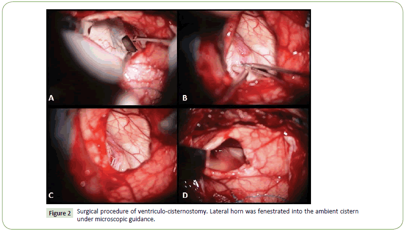 Neurology-Neuroscien-surgical-procedure