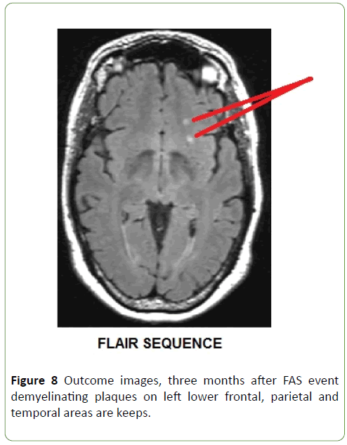 Neurology-Neuroscien-temporal