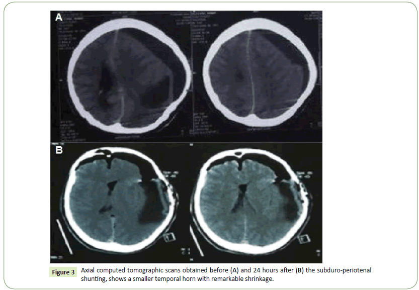 Neurology-Neuroscien-tomographic